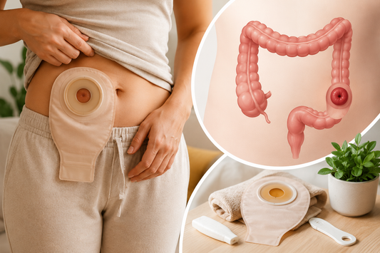 Colostomy Explained: What to Expect