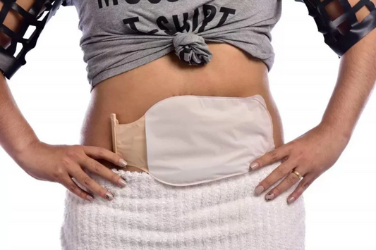 What Is a Stoma Bag and How Does It Work?