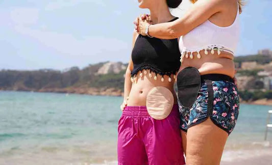 Living With a Stoma: Daily Tips for Comfort and Confidence
