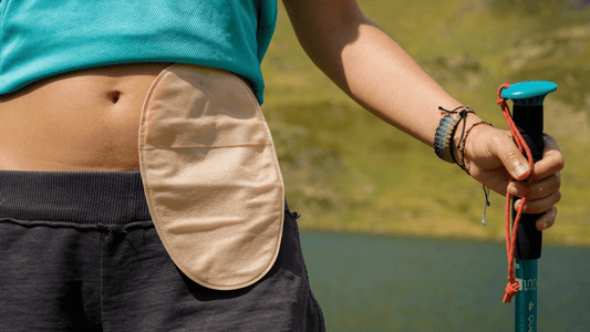 What Is a Stoma? Everything Beginners Need to Know
